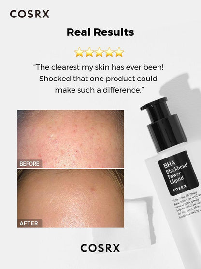 BHA Blackhead Power Liquid - exfoliating toner with BHA acid